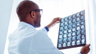 南加州大学诺里斯综合癌症中心将在纽波特比奇开设放射肿瘤学和影像中心