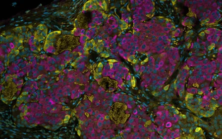 科学家创造了一种能阻止恶性生长的细胞
